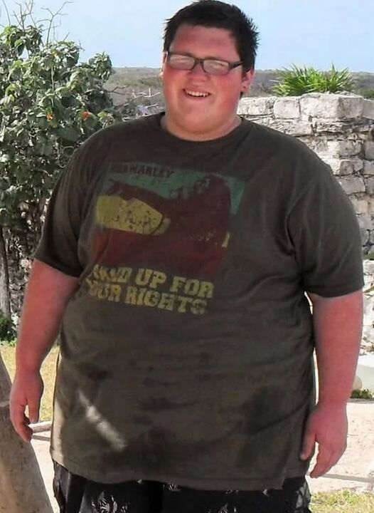 Παχυσαρκία πριν από τη χρήση keto probiotix